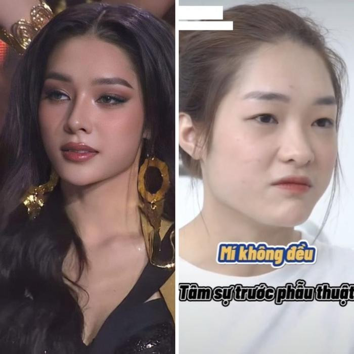 Á HậU Miss Grand Vietnam 2023 &Amp;Quot;đậP MặT XâY LạI&Amp;Quot;: KhôNg NhậN Ra ThờI ChưA &Amp;Quot;Dao KéO&Amp;Quot;, Visual HiệN TạI Như Mỹ NhâN TháI - ẢNh 4.