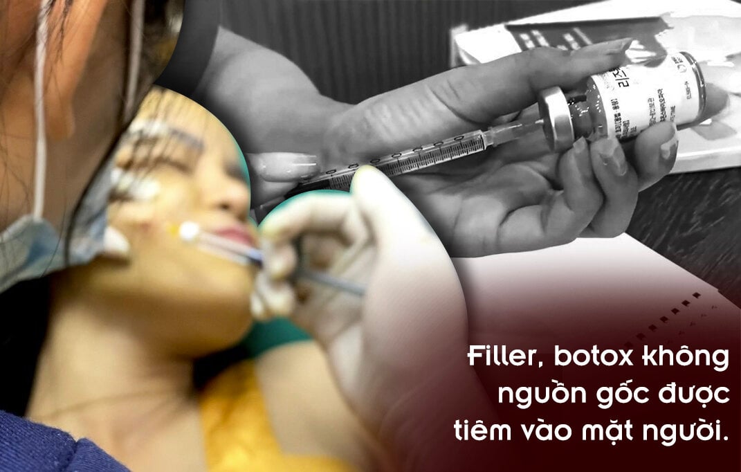 GóC TốI Thị TrườNg Filler &Amp;Quot;XịN&Amp;Quot;: HàNg RảI BáN TrêN đườNg DùNg TiêM VàO MặT NgườI - ẢNh 8.