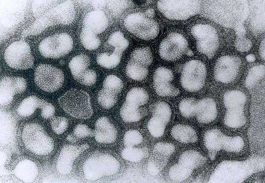 10 Loại Virus Gây Chết Người Nguy Hiểm Nhất Thế Giới 9