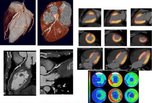 Ứng Dụng Kỹ Thuật Pet Và Pet/Ct Trong Lâm Sàng 3