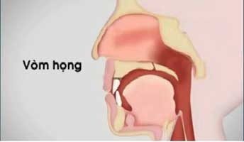 Triệu Chứng Và Điều Trị Ung Thư Vòm Họng 1