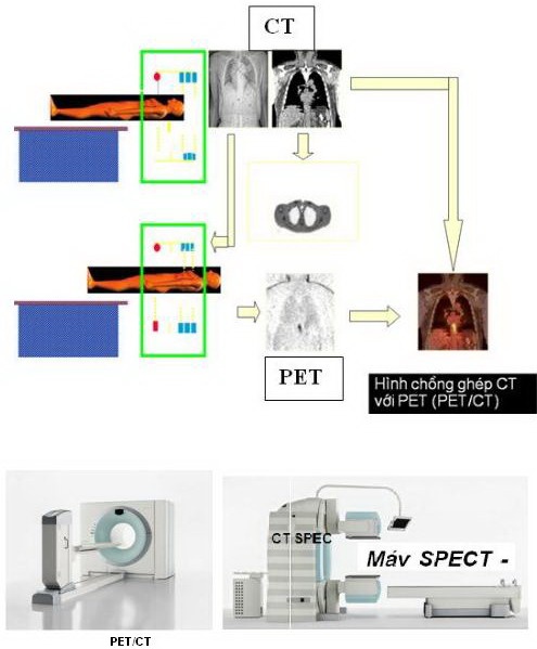 Ứng Dụng Kỹ Thuật Pet Và Pet/Ct Trong Lâm Sàng 5