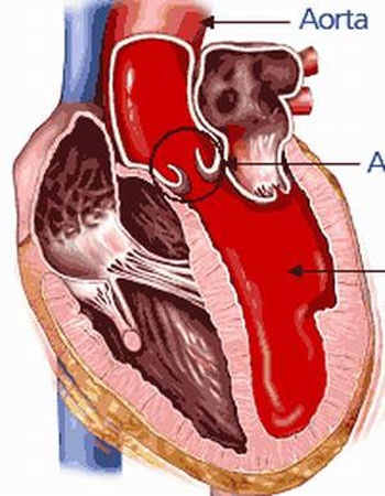 Huyết Áp Kẹt Nguy Hiểm Thế Nào? 2