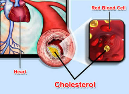 Dùng Thuốc Chữa Tăng Lipid Máu - Cần Lưu Ý Gì? 1