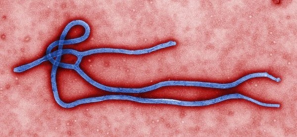 Điều Cần Biết Về Đại Dịch Ebola Đang Đe Dọa Thế Giới 3