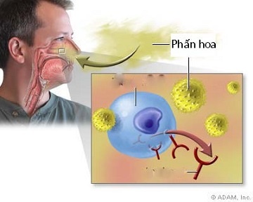 Phòng Viêm Mũi Họng Ngày Xuân 1