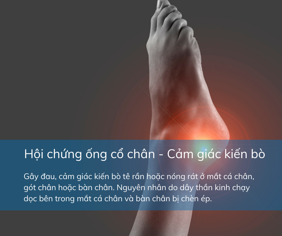 CảM GiáC KiếN Bò ở LòNg ChâN Có Thể CảNh BáO BệNh Lý MãN TíNh Nguy HiểM - ẢNh 5.