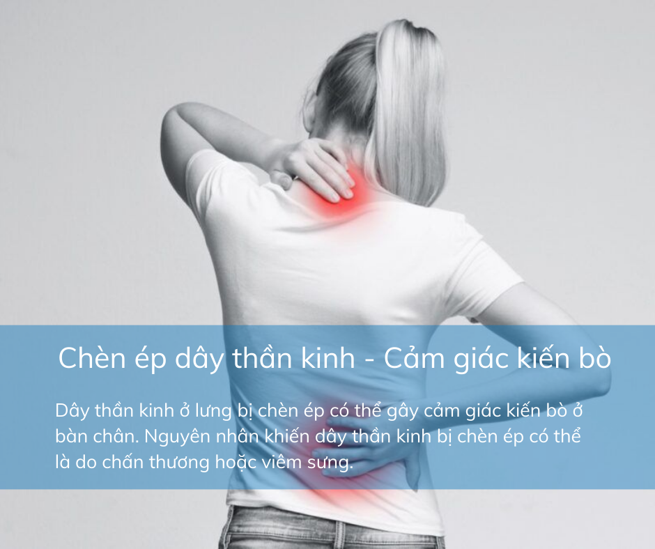 CảM GiáC KiếN Bò ở LòNg ChâN Có Thể CảNh BáO BệNh Lý MãN TíNh Nguy HiểM - ẢNh 12.