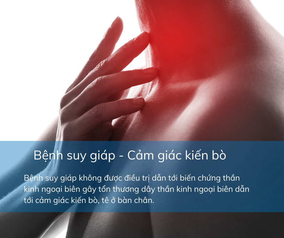 CảM GiáC KiếN Bò ở LòNg ChâN Có Thể CảNh BáO BệNh Lý MãN TíNh Nguy HiểM - ẢNh 4.