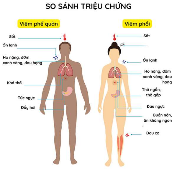 Bị Viêm Phế Quản Có Sốt Không? 3