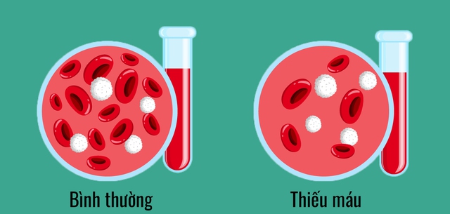 Trà Xanh CựC TốT NhưNg ẩN ChứA 11 TáC DụNg Phụ Nguy HiểM íT NgườI BiếT, DâN VăN PhòNg NghiềN Trà đá VỉA Hè CầN ThậN TrọNg - ẢNh 4.